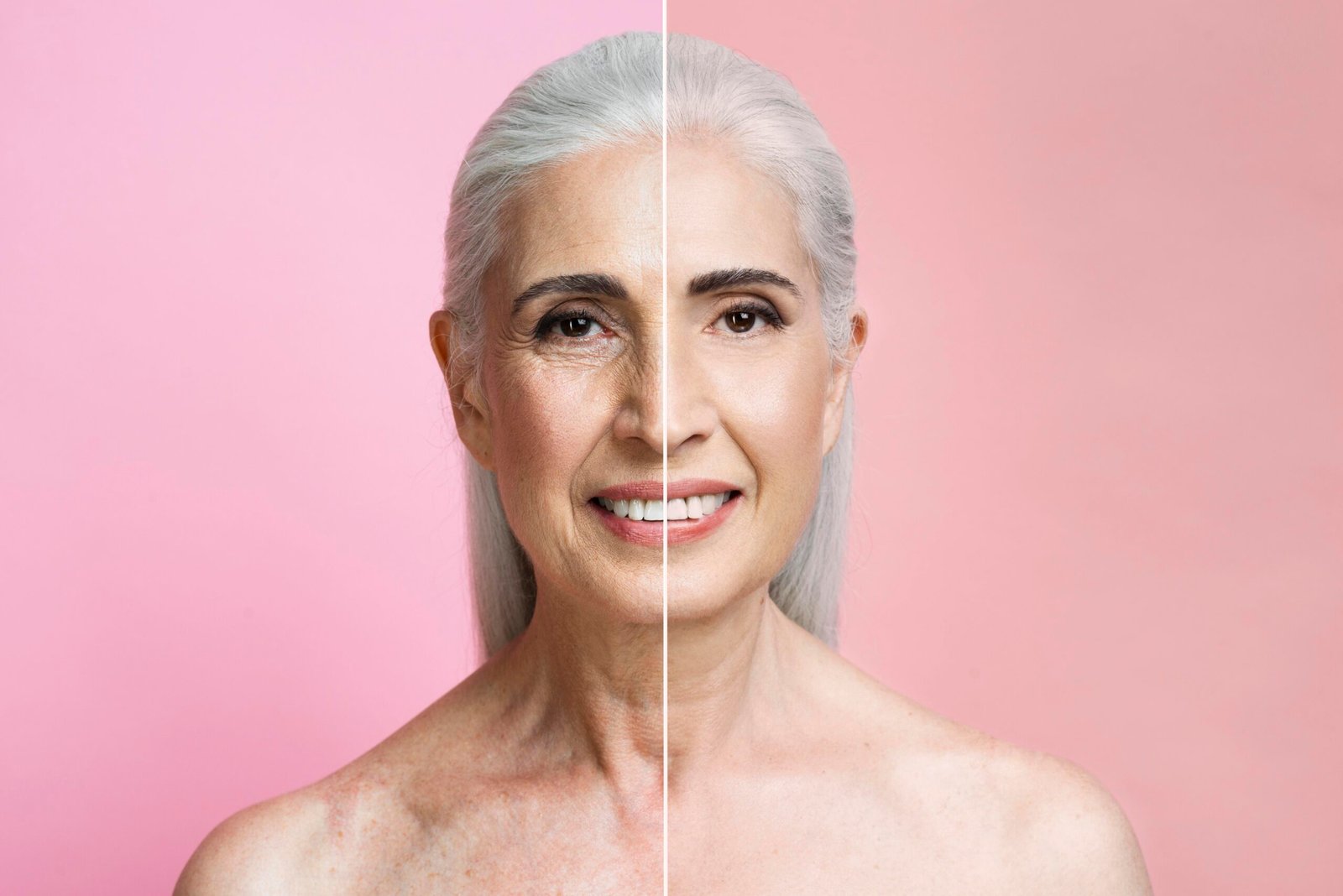 Wrinkle Reduction and Uneven Skin Tone