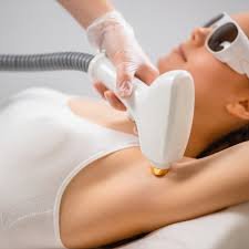 Goodbye Unwanted Hair: The Benefits of Laser Hair Removal